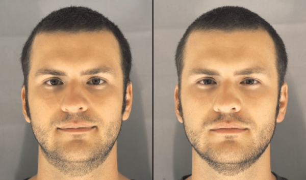 숙면에 따른 얼굴의 변화, 출처 BMJ,2010;341:c6614